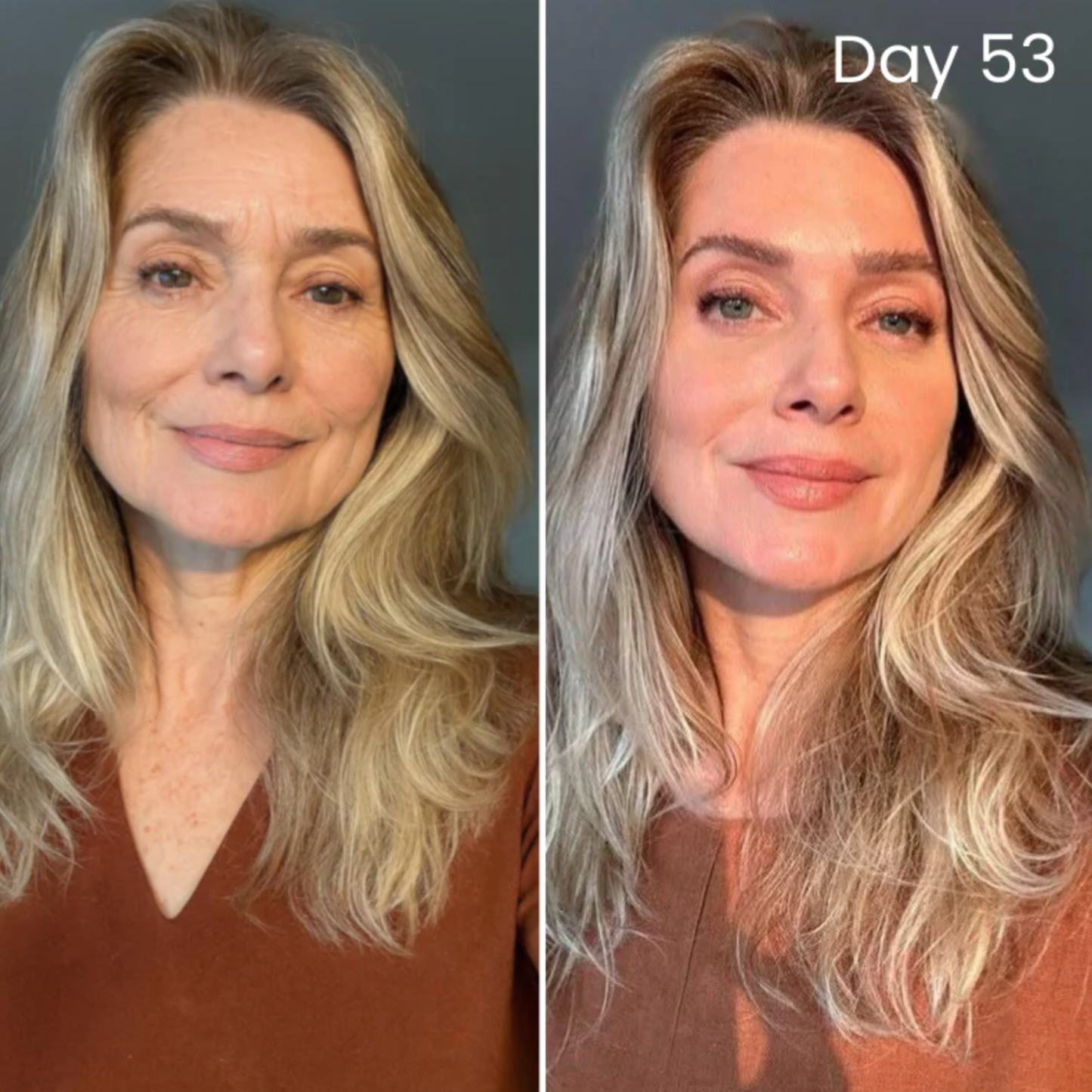 GlowPlex - Wake Up to Smoother, Firmer Skin