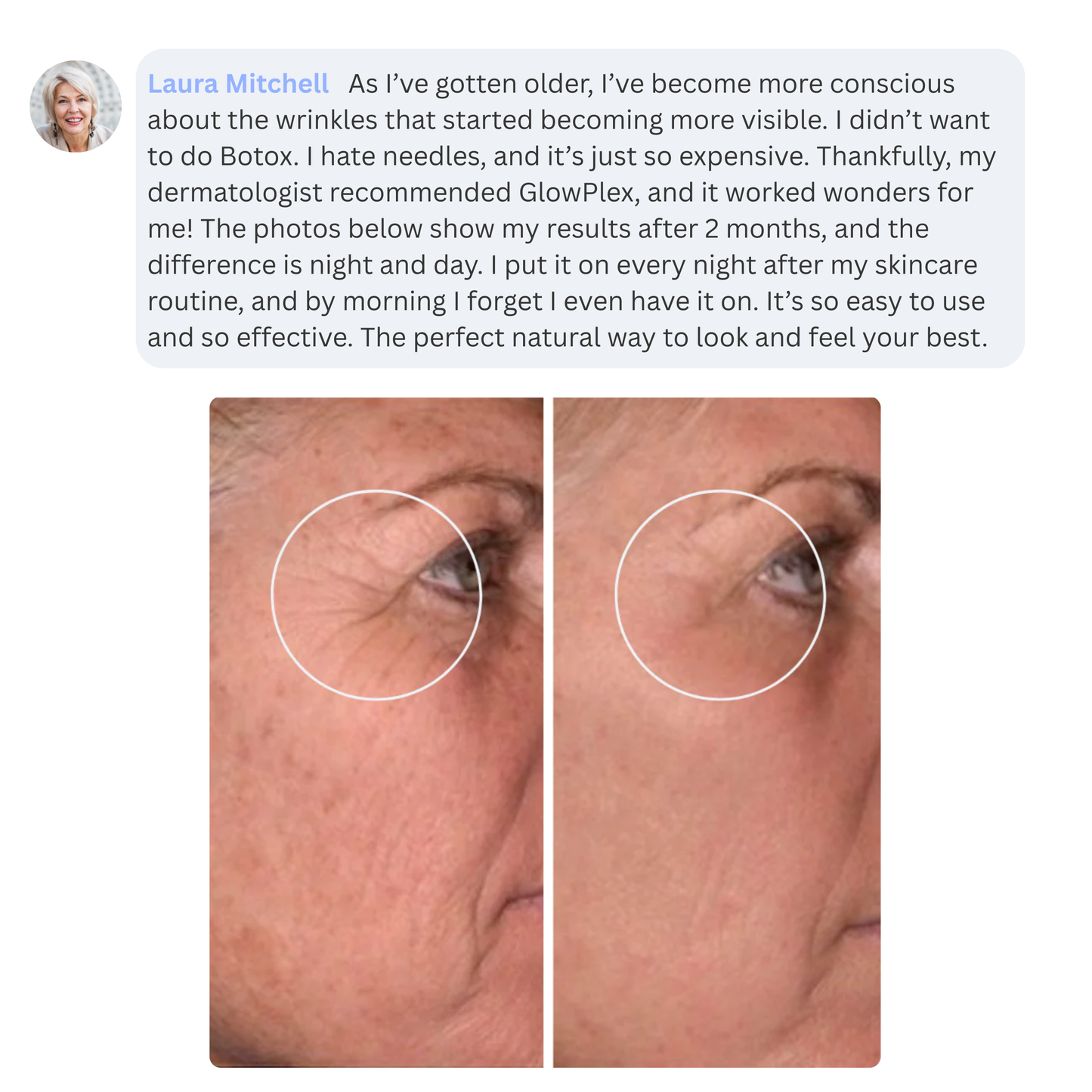 GlowPlex - Wake Up to Smoother, Firmer Skin